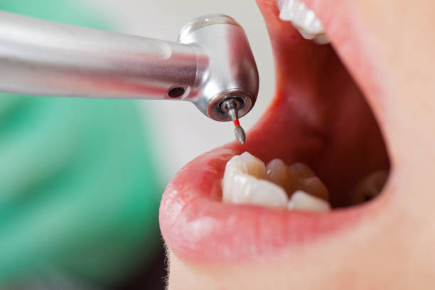 Best Weekend Emergency Dentist in Buellton, CA